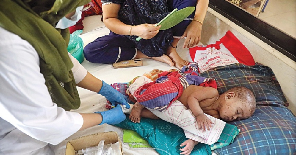 হাম উপসর্গে আরো ৪ শিশুর মৃত্যু
